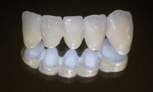 nuevo-material-biohpp-para-protesis-1