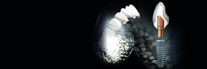 nuevo-material-biohpp-para-protesis-2